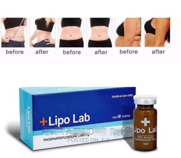 Wholesale 10vials/Box Liquid Lipo Lab Ppc Solution Meso V Line Fat Reducing Injection Lipolytic for Adipose Dissolve Fusion F-Xbc Saxandra Pen