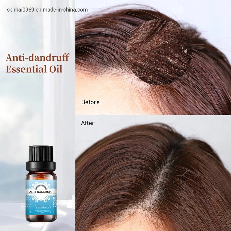 100% Pure Natural Massage Blend Essential Oil Hair Oil Anti-Dandruff Essential Oil for Shampoo