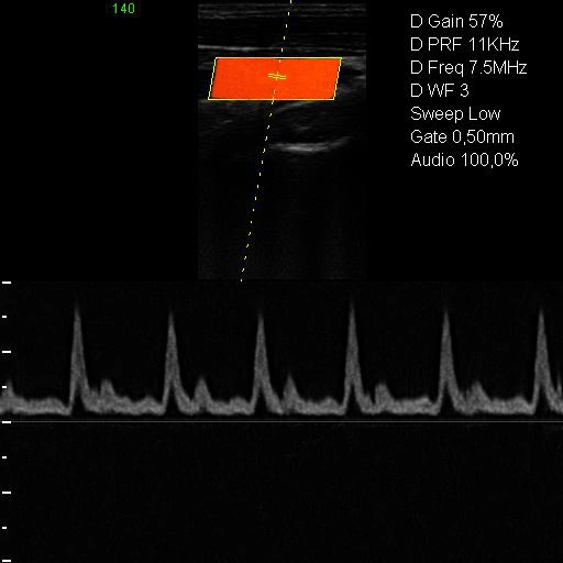 Cheap Price 4D Trolley Sonograph K10