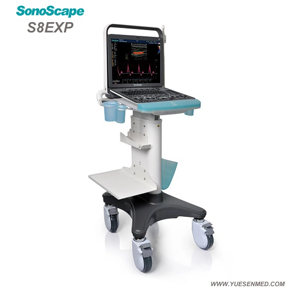 Medical Sonoscape S8exp máquina de ultrasonido Escáner portátil barato