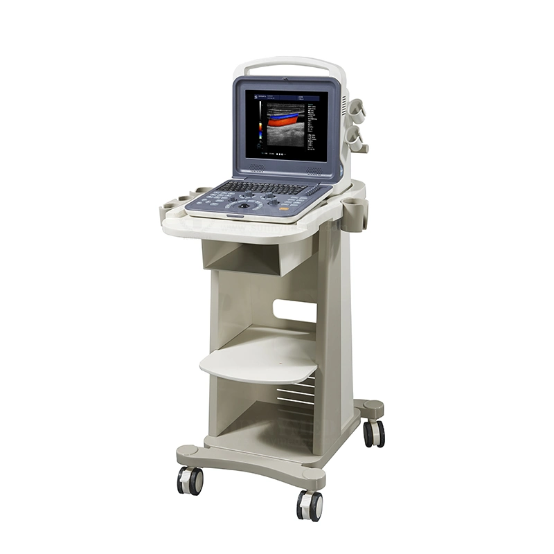 Sy-A042n Cheap Color Doppler Handy Baby Scanner Medical Digital Ultrasonography Ultrasound Machine Price