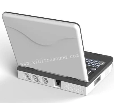 Laptop Tragbares 3D Ultraschall-Scanner Farbdoppler-Imaging-Diagnosesystem Wirtschaftlich