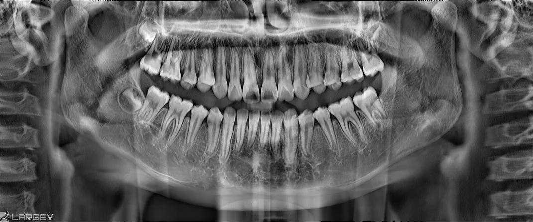 Smart3d-X 3-em-1 Todos Treatmen Ortodôntico imagem extraordinária T novo Intelligent Térm Cbct Equipamento do scanner