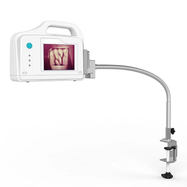 Infrared Portable Vein Locator Vein Detector