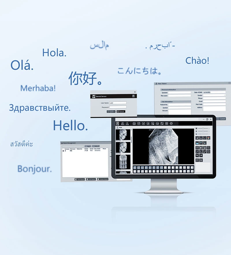 Software del sistema Intraoral Digital de transmisión rápida de rayos X para el sensor dental médico Longitud del cable