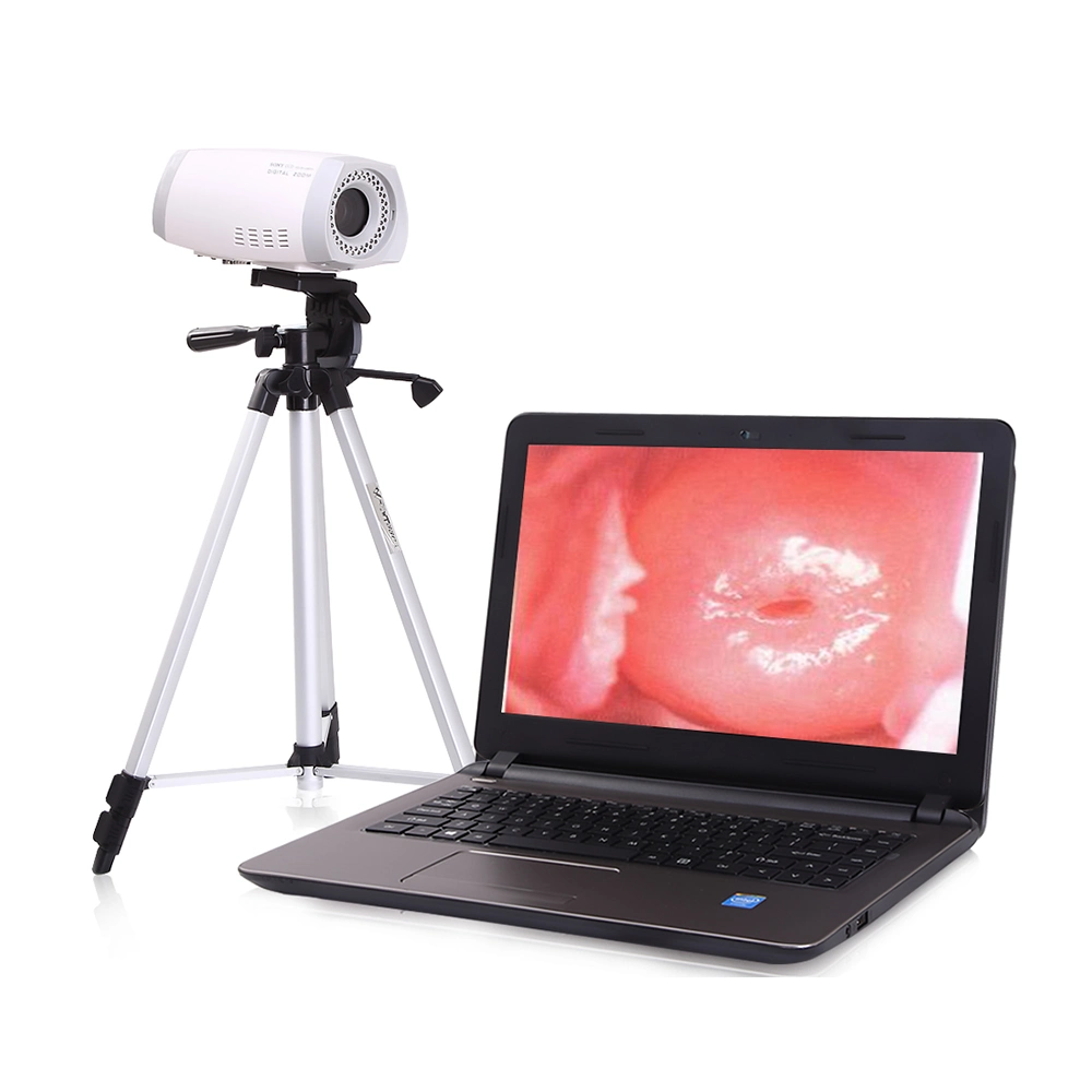 HD Digital Video Colposcope/Gyneology with Tripod