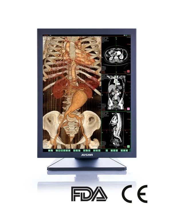 Ce FDA aprobó el Monitor de paciente para el diagnóstico de rayos X