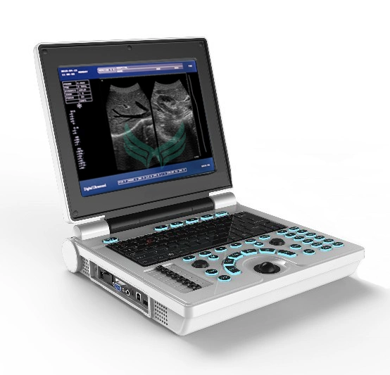 Ноутбук ультразвукового сканера по правам и ветеринарных XF30b