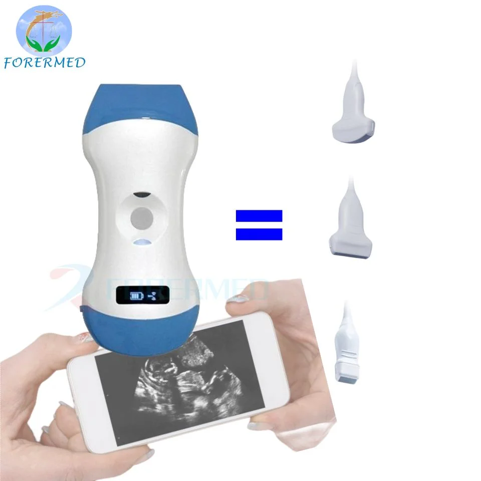 Portable Wireless Ultrasound Scanner Linear/Convex/Cardiac 3-in 1 Color Ultrasound