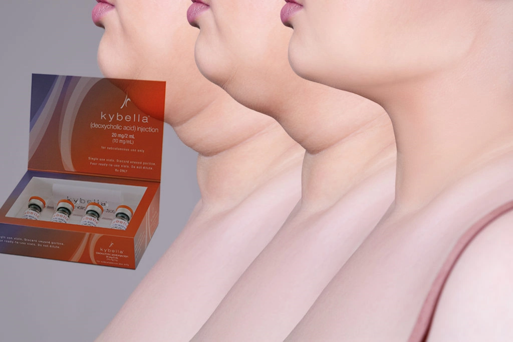 La FDA aprobó el tratamiento inyectable Kybella disuelve la grasa para reducir el exceso de la almohadilla grasa Submentonianos Aka Double-Chin