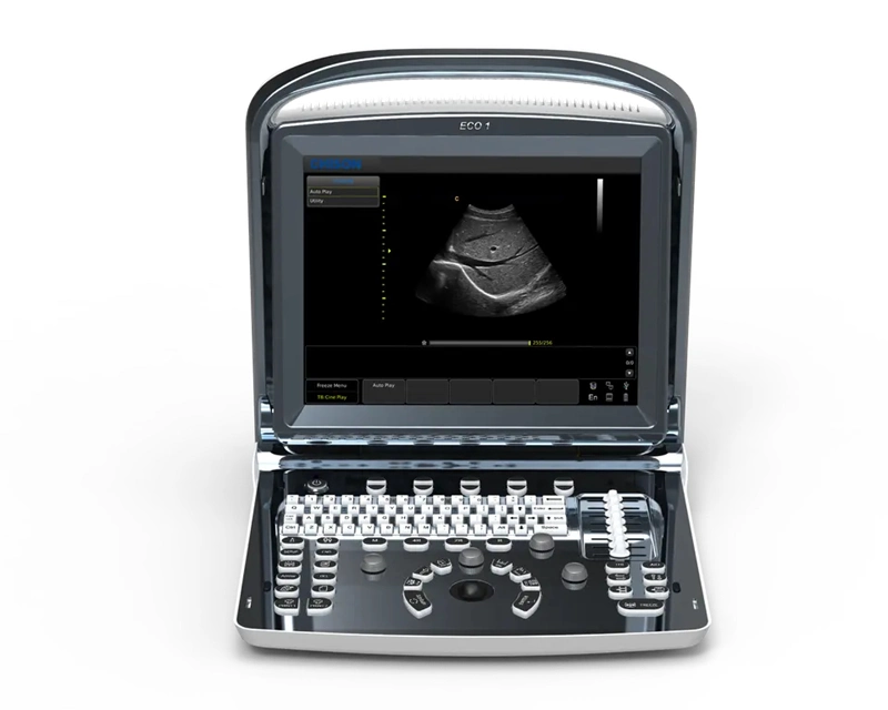 Chison Eco1 Ultrasound Machine with CE Portable Ultrasound Scanner