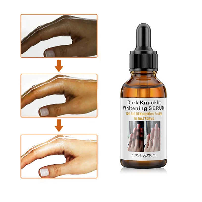 Cross-Border Joint Brighteningknee Ankle Melanin Removal Essence