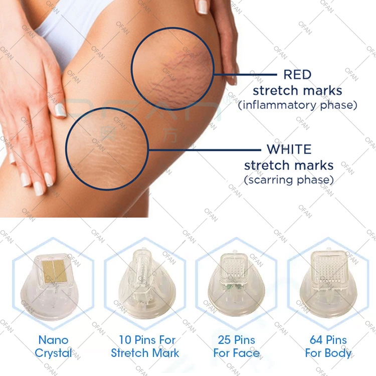 Anti-Falten-Geräte Elektrodennadeln Stretch Mark Scar Entfernung Haut Verjüngungsmaschine Micro Needle RF