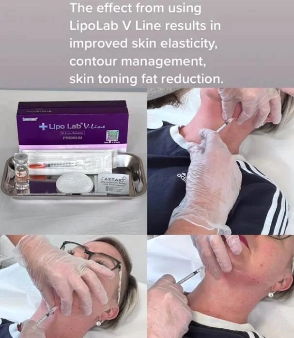 Kybella Allergan Belkyra Fat Dissolver Results Swelling for Double Chin Reduction Nom-Surgical Neck Fat Loss Weight Injection Kabelline Lemonbottle Ozempics