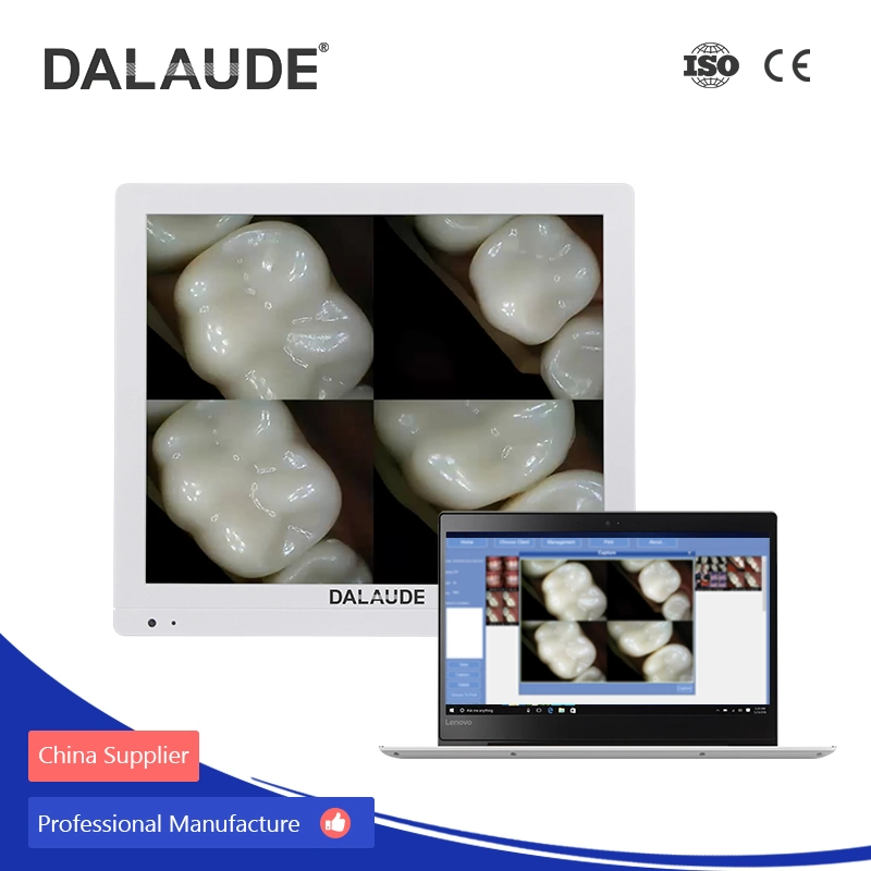 HD de 10 MP con 17 pulgadas de cristal blindado Dental monitor Visor de Cámara digital Cámara Intraoral Cámara oral con Multimedia y conexión inalámbrica a la cámara con una memoria USB