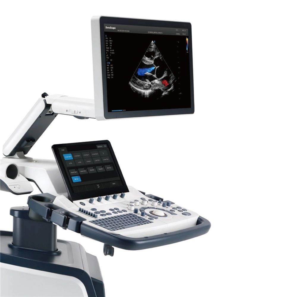 Sonoscape S60 13.3 Inch Quick Responsive Touch Screen Color Doppler Trolley Ultrasound Machine