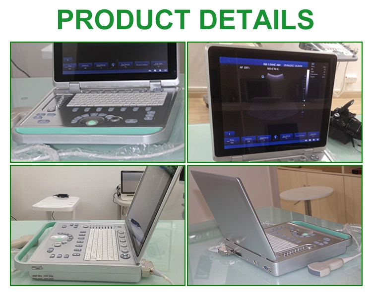 IN-A032-2 15 Inch Medical B & W Ultrasound Scanner Machine