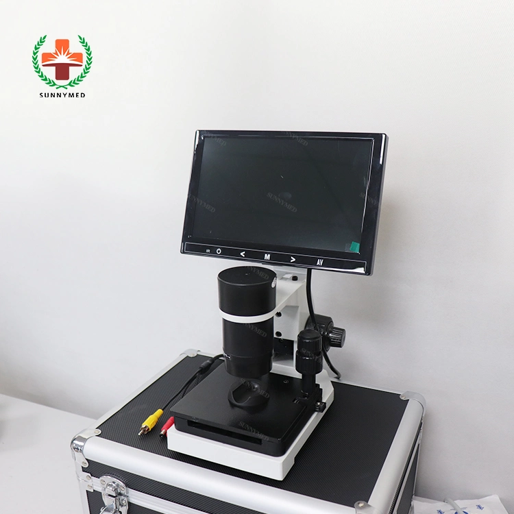 Micro Circulation Medical Hospital Machine Capillary Microscope