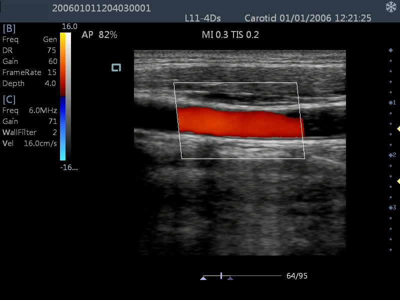 Am-5000 Full-Digital Color Doppler Ultrasound Diagnostic System Ultrasound Scanner