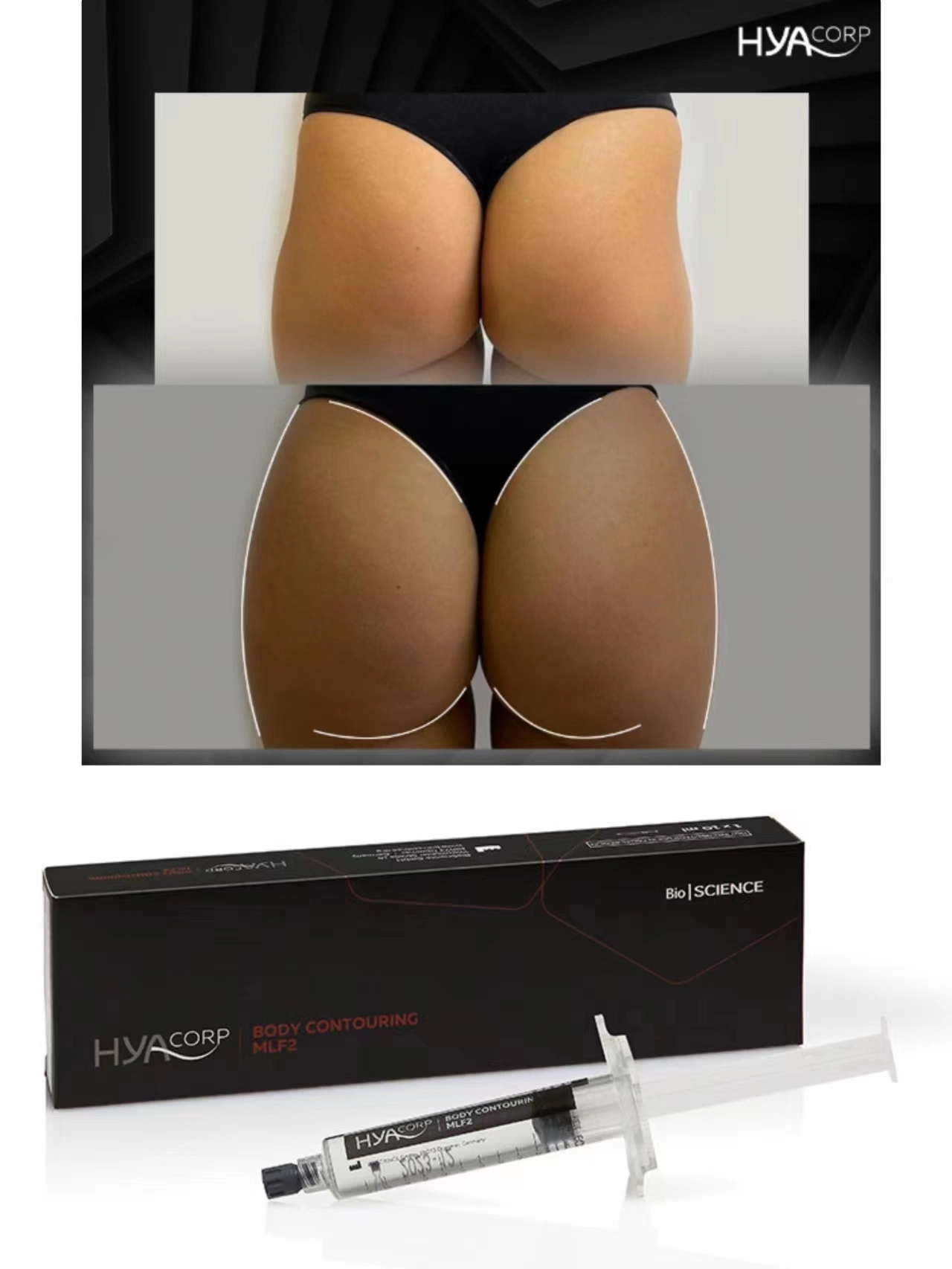 Hyacorp 10ml Body Breast Buttock Enhancement Body Contouring Cross Linked Ha Wange Füllung Tief