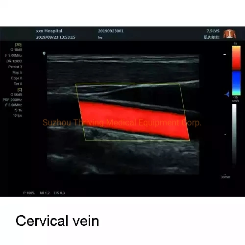 Medical Diagnostic Equipment Full Digital Portable Ultrasound Device for Hospital and Clinic