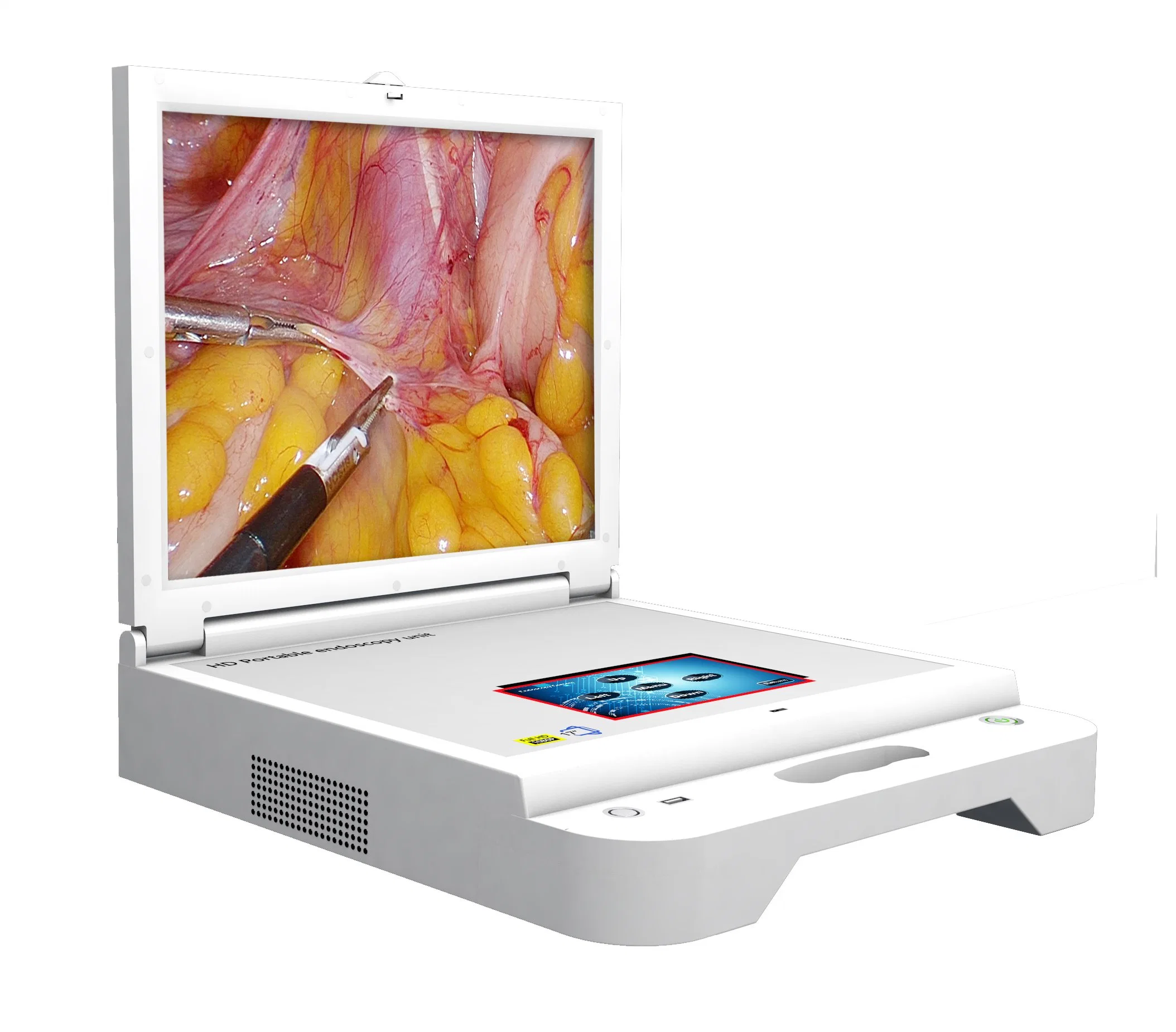 Портативный эндоскопический монитор LCD Medical Diagnosis Equipment HD Portable Endoscope System Жесткая эндоскопия для Энта