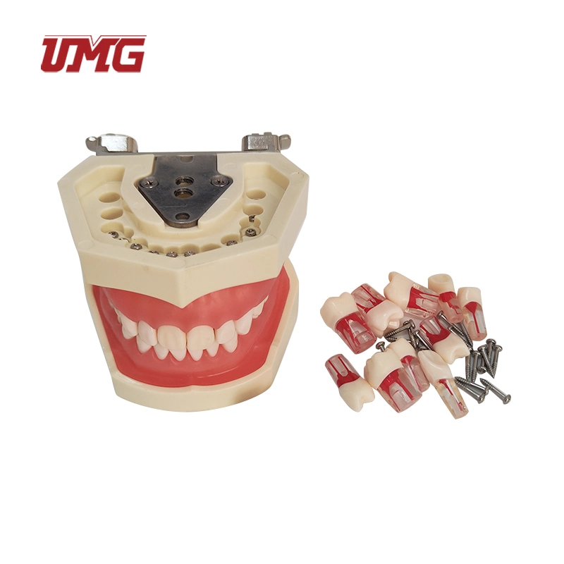 Dental Practise Model Teeth Root Canal Filling Model