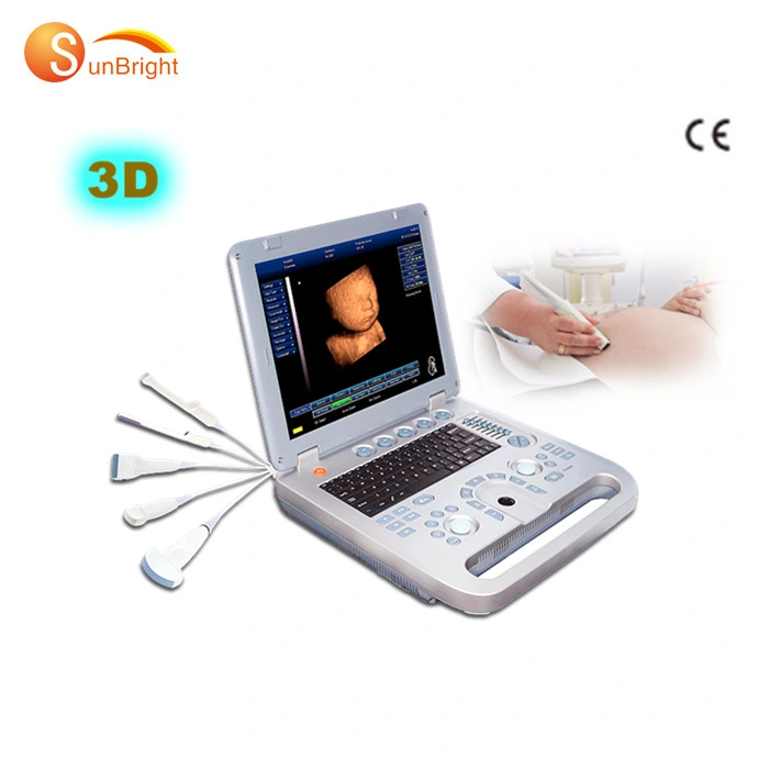 Sun-800d Cheap Ecograph Laptop Notebook Portable Ultrasound Scanner