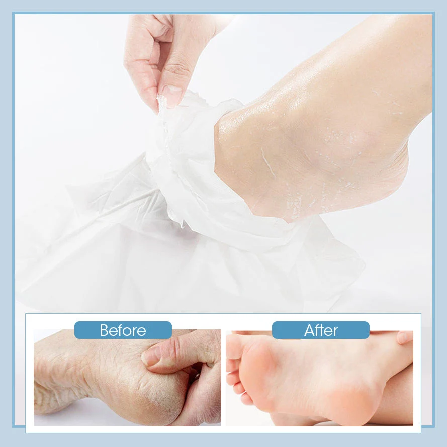 OEM Your Logo Wholesale/Supplier Nourishing Korea Aloe Skin Peeling Exfoliating Moisturizing Peel Foot Mask