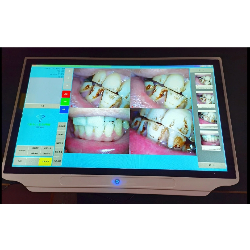 Good Quality Video Dental Endoscope Digital Dental Intra-Oral Camera