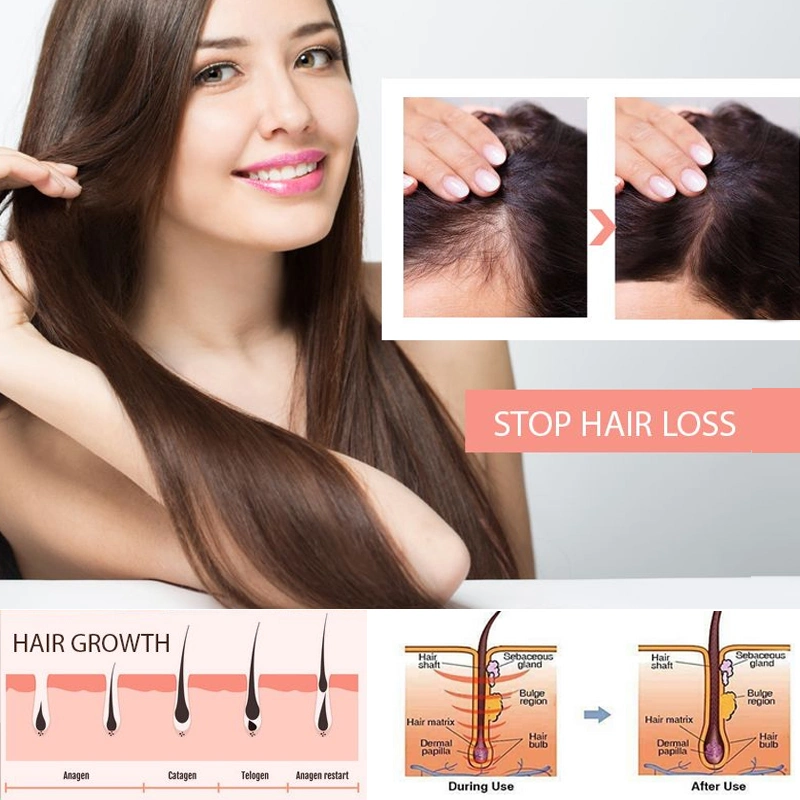 FDA Approved Distillation Serum Ginger Straightener Argan Oil Prevent Thinning Hair Loss Manufacture