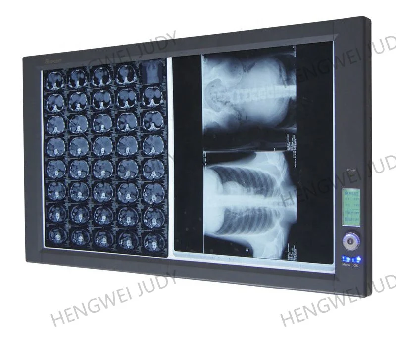 Manufacturer Medical LED X-ray Film Illuminator Dental X-ray Viewer Oral Therapy Equipments & Accessories 30W Class I 4500~5500K