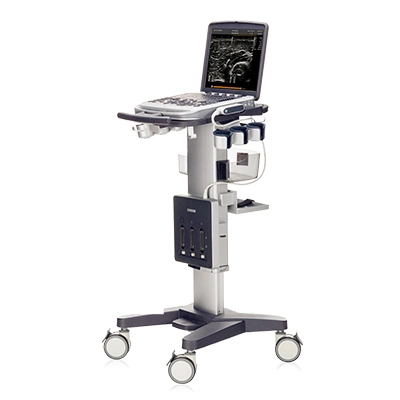 Chison Sonobook 6 Portable Color Doppler Ultrasound System