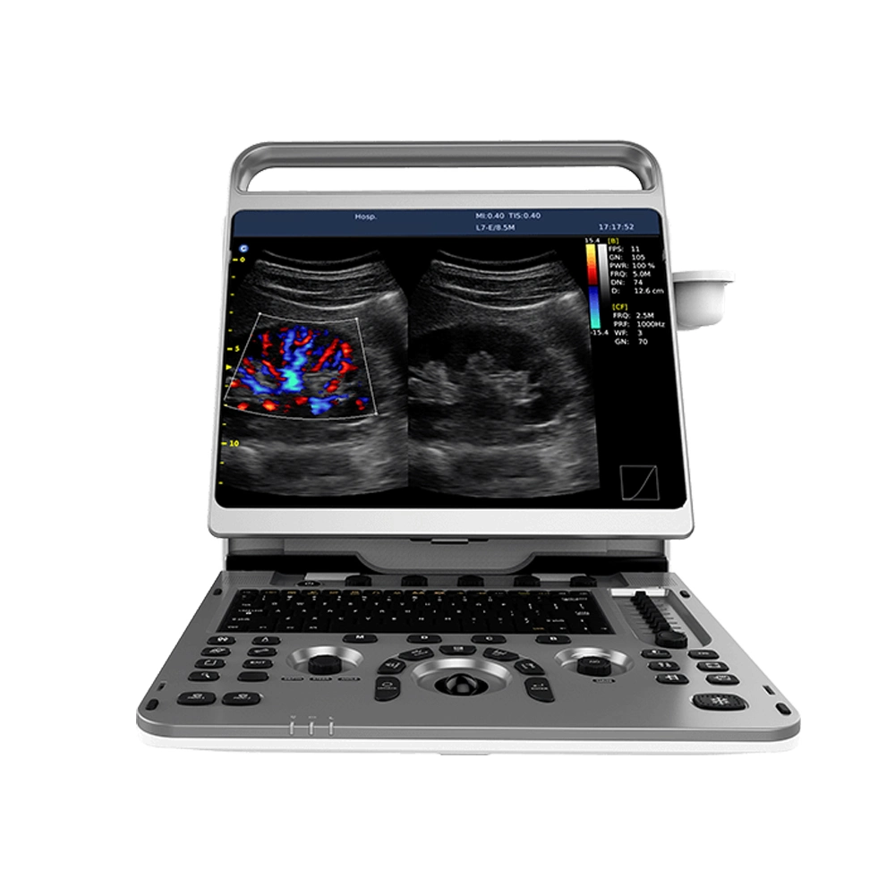 Chison Ebit50 4D 5D Portable Color Doppler Digital Dianostic Imaging System Human Ultrasound Gynecology, Cardiovascular Echo Machine