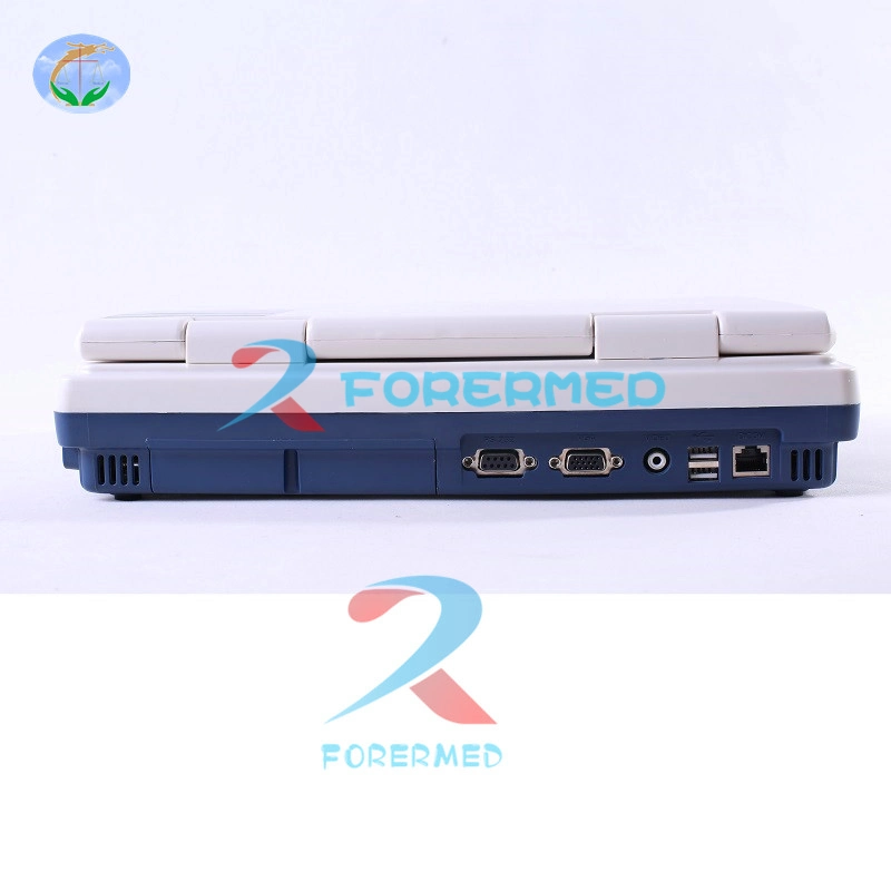 China Manufacturer Diagnostic Imaging Portable Sonar Ultrasound Scanner