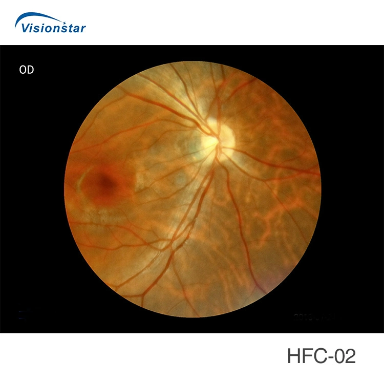 El enfoque automático 16MP de resolución el HFC-02 Fundus portátil cámara