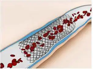 Stent intravascular