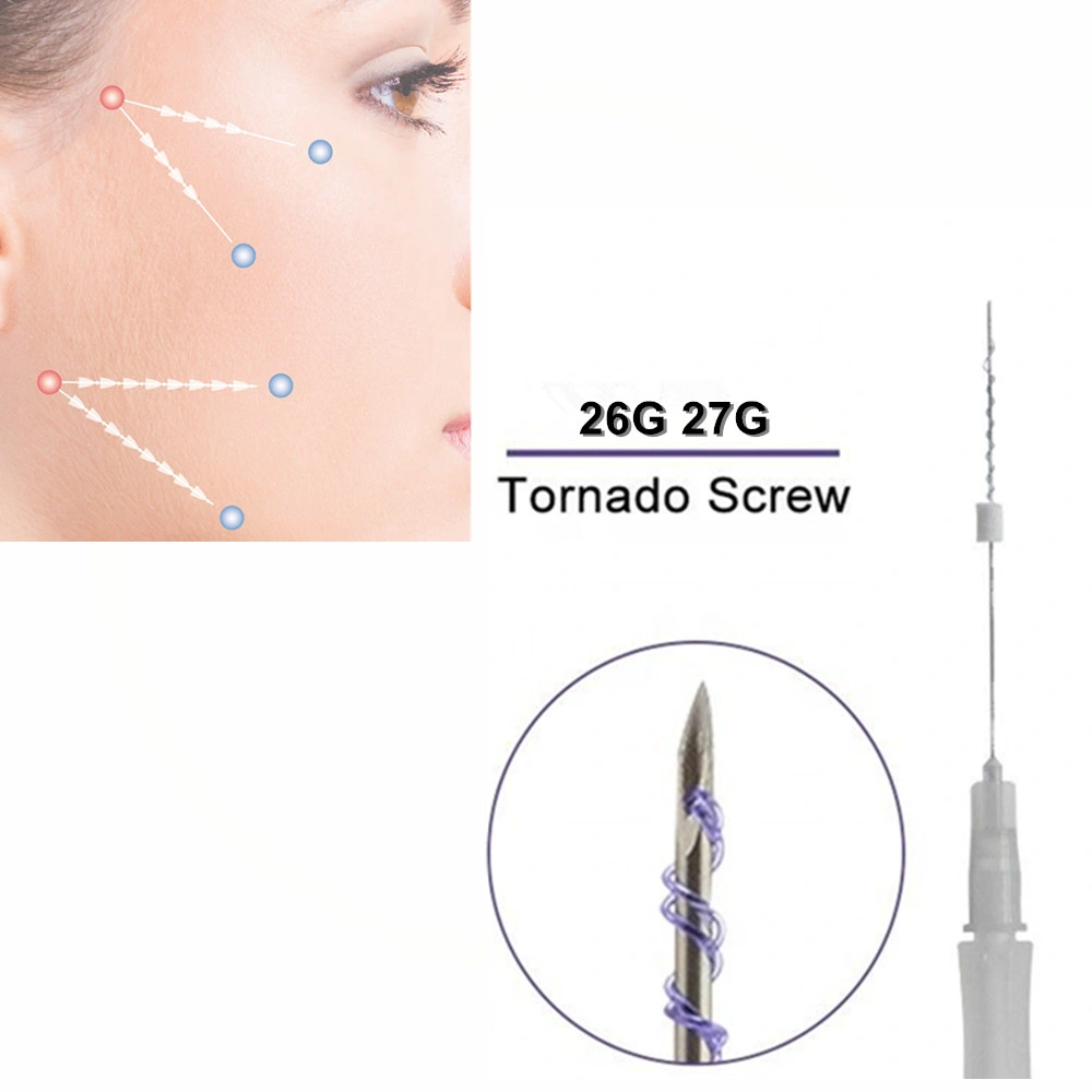 Medical Supply Tornado Screw Pdo Pcl Lifting Thread for Removing Wrinkles