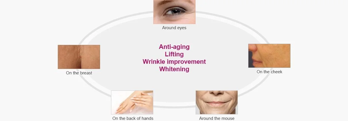 Miracle L H Pcl Serum Collagen Fillers Injections Miracle Touch up with 5pin Needle Mesotherapy Skin Boosters Aqua Lifting Collagen Rejuvenation Miracle L