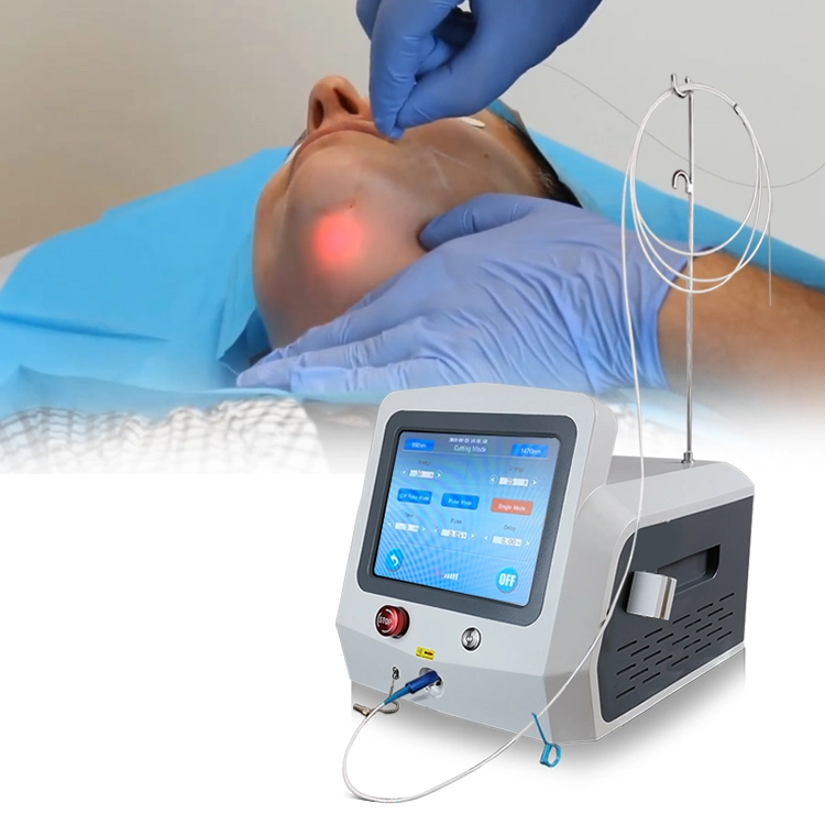 maquina de disolucin de grasa liposuccion vaser laser 1470nm 980nm diodo lser lipopapada