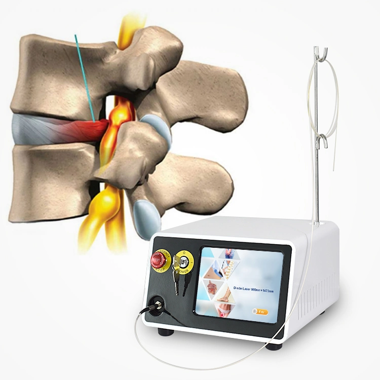 10 en 1 980nm 1470nm Diode laser Surgery Pldd Treatment Équipement médical