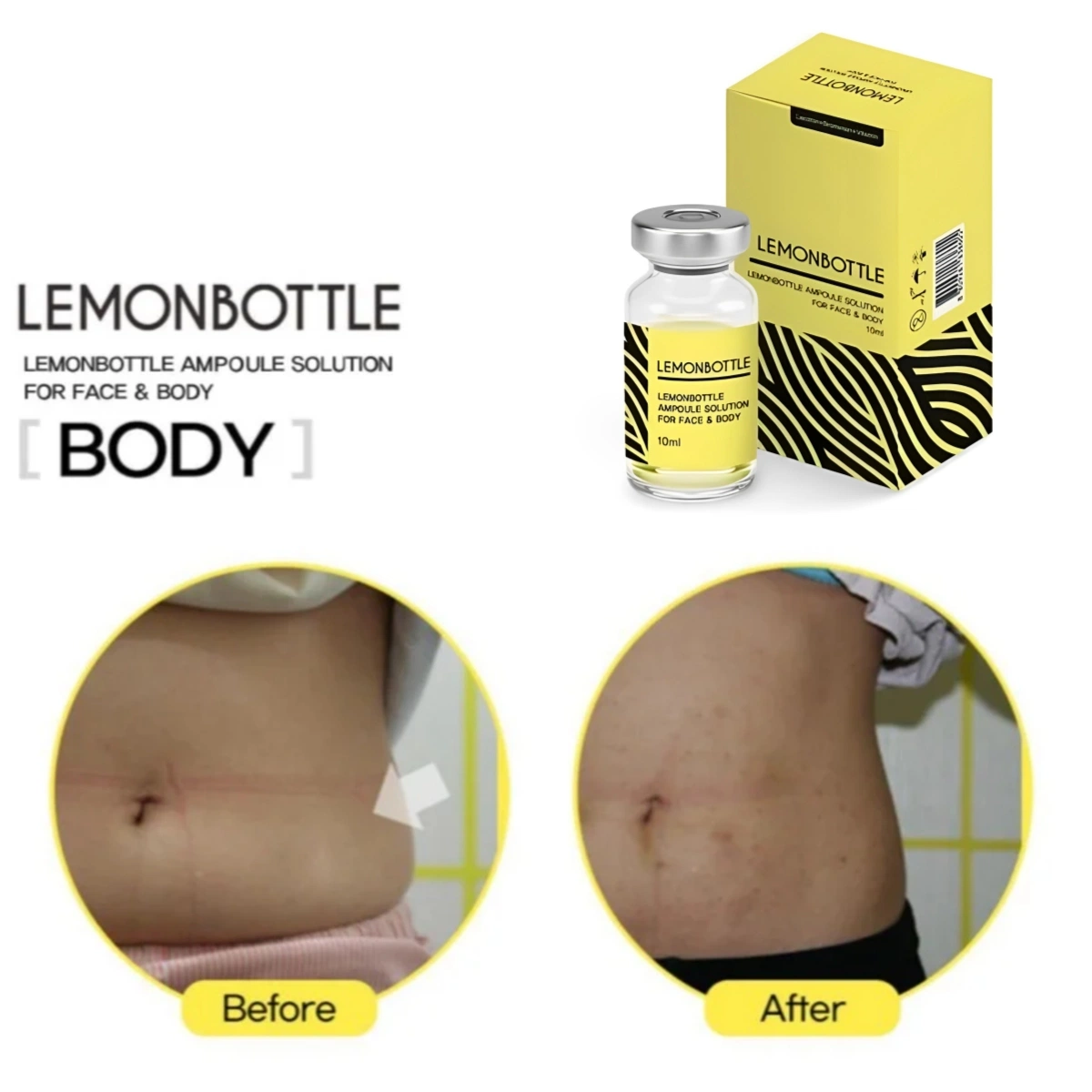 Wholesale Slimming Injection Lemon Bottle 5 10ml Semaglutide 5mg Semiglutide 10mg Tirzepatide Lipolyses for Fat Dissolving Fat Dissolve Loss Weight