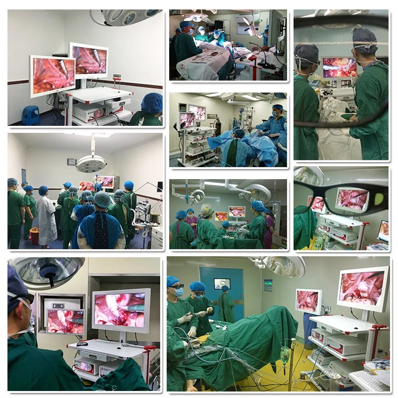 3D HD Endoscopie Camera System for The General Surgery