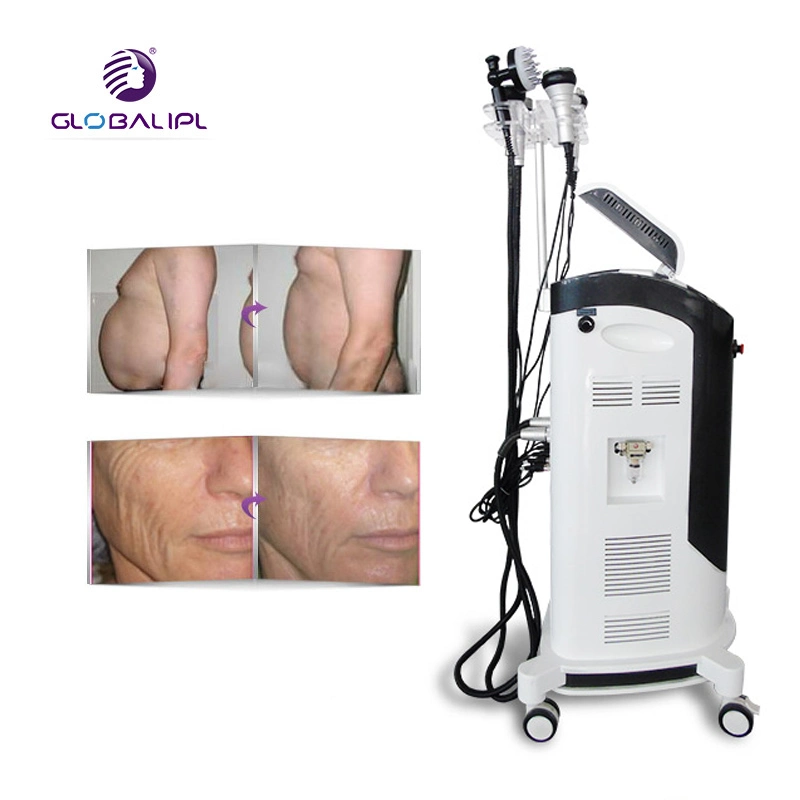 Hot Sale Liposuction Ultrasonic Cavitation Slimming Machine