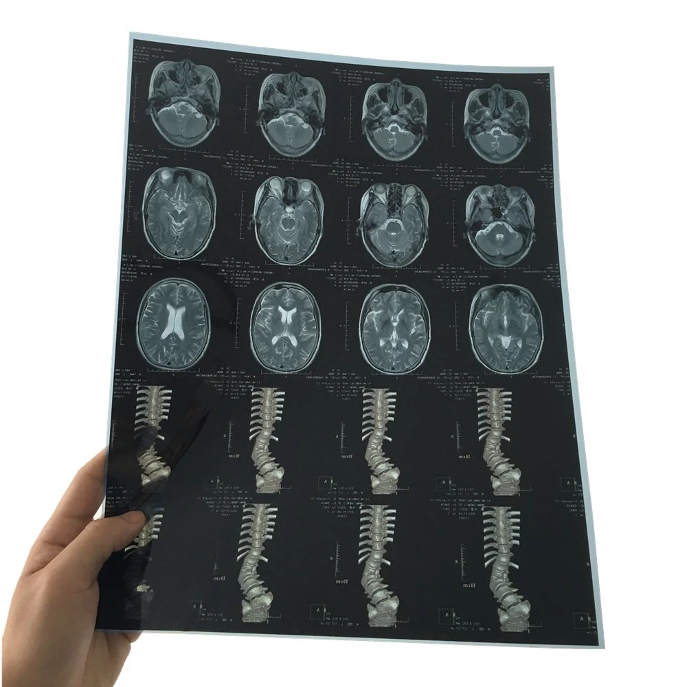 La radiographie numérique des films/image pour l'hôpital