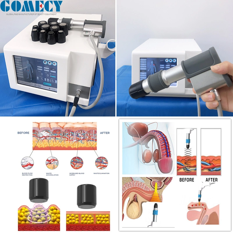 Professional Fisioterapia Eswt Shockwave Sistema de terapia para o alívio da dor de Fisioterapia Tratamento ED