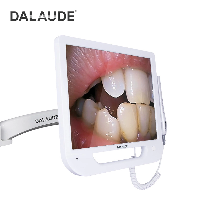 Monitor with Handle Dental Digital Camera Viewer Intraoral Camera Oral Camera and Wi-Fi Camera 10 MP HD with USB Stick