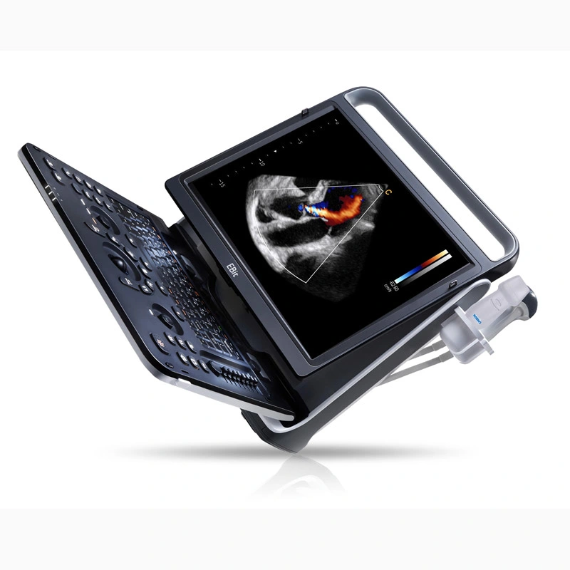 Chison Ebit50 4D 5D Portable Color Doppler Digital Dianostic Imaging System Human Ultrasound Gynecology, Cardiovascular Echo Machine