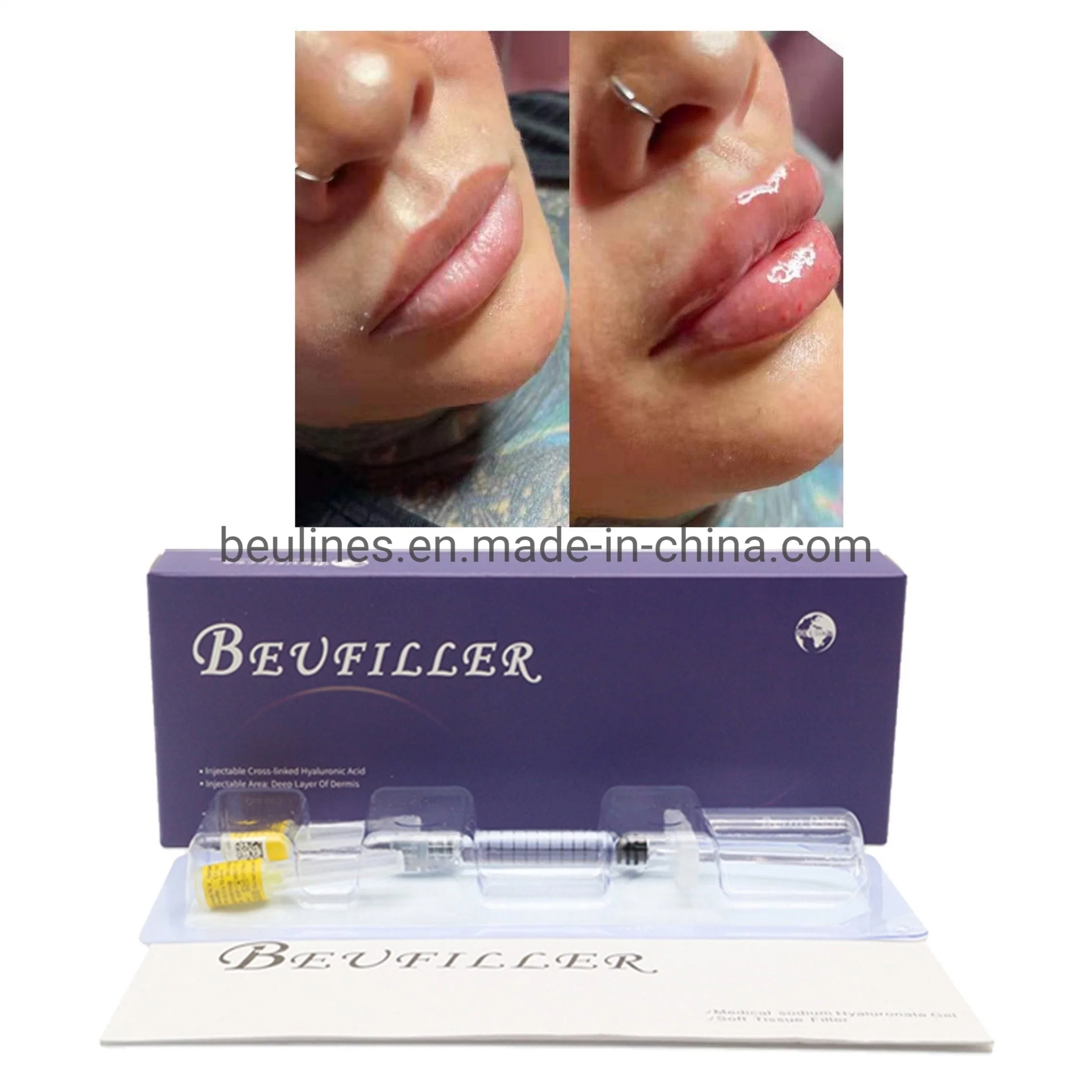 CE Corée Stylo coréen 1ml 2ml 10ml Ha Injectable Cross Linked Face Butt Breast Enlargement Jaw Jawline Cheek Chin Nose Under Eye Lip Hyaluronic Acid Dermal Filler.