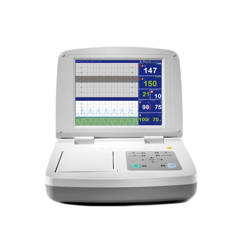 Medical Equipment 10.4inch Screen Fetal Heart Rate Monitor Ctg Machine with Bulit-in Printer